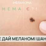 Меланома: що важливо знати кожному