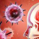 Вірусний енцефаліт: що важливо знати?